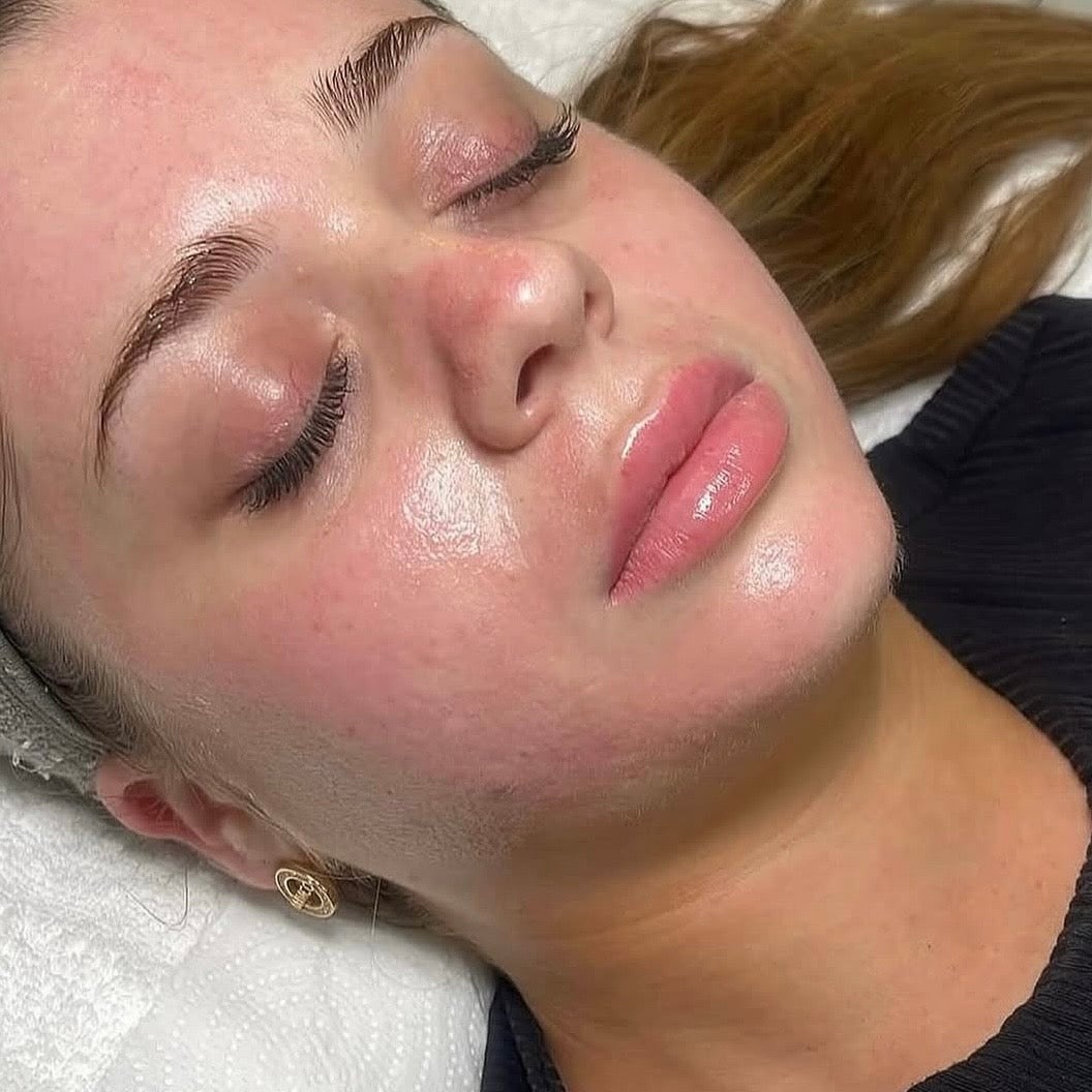 Glowing skin after a facial at Derma Corner
